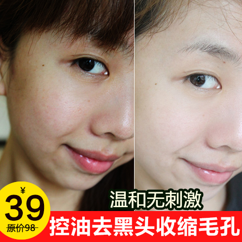 火山泥洗面奶男女士竹炭控油去黑头粉刺深层清洁洁面乳美白保湿